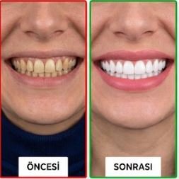 Bahar Diş Kliniği Görsel 1