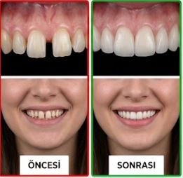 Bahar Diş Kliniği Görsel 2