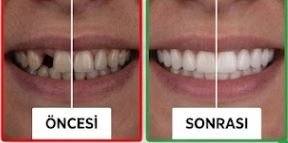 Bahar Diş Kliniği Görsel 5